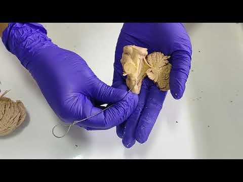 Dissection - Anatomy of  Fourth Ventricle