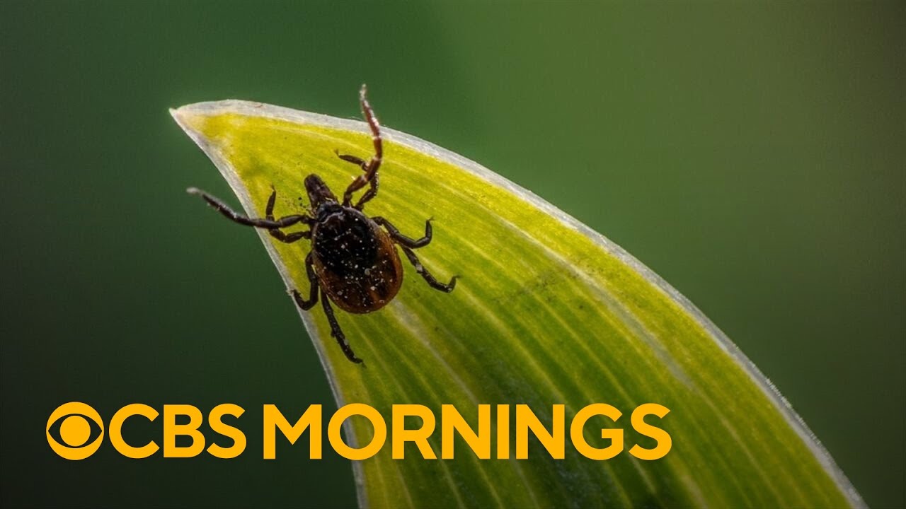 Tick season is sending more people to hospitals. Here's how you can protect yourself.