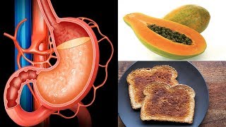 Foods To Ease an Upset Stomach | Top Foods to Ease an Upset Stomach
