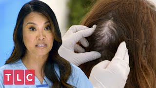 Patient Has a Huge Lipoma on the Back of Her Head! | Dr. Pimple Popper