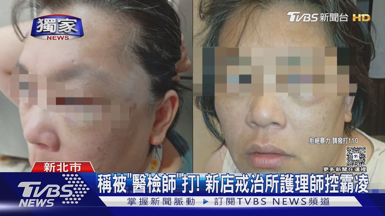 獨／新店戒治所護理師控「遭醫檢師痛毆」　同事撕破臉互告