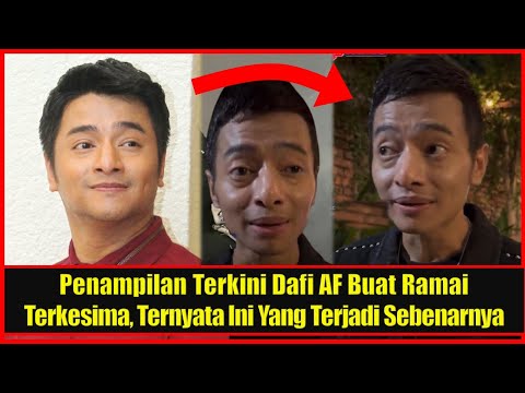 Penampilan Terkini Dafi AF Buat Ramai Terkesima, Ternyata Ini Yang Terjadi Sebenarnya