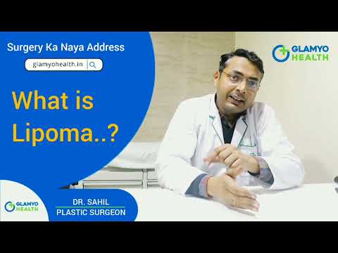 Does Lipoma Cause Cancer? How Glamyo Health Cure Lipoma | Glamyo Health Expert's Advice
