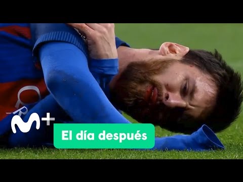 El Día Después (24/04/2017): El Clásico de Messi