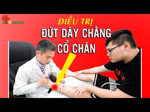 ĐỨT DÂY CHẰNG CỔ CHÂN - Điều trị và Phục hồi HIỆU QUẢ | Bác sĩ Thể thao Nguyễn Trọng Thuỷ