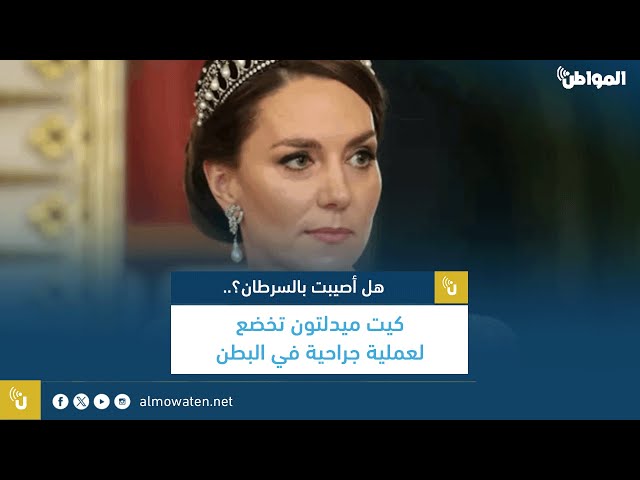 كيت ميدلتون تخضع لعملية جراحية في البطن.. هل أصيبت بالسرطان؟