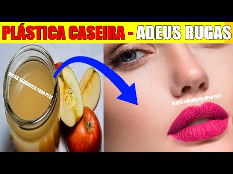 PLASTICA CASEIRA - ADEUS RUGAS: Técnica para eliminar RUGAS, Pele Flácida, Marcas e Manchas na Pele