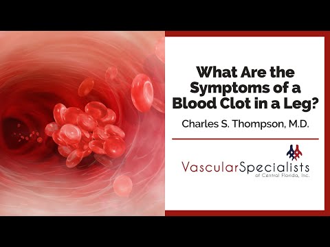 What Are the Symptoms of a Blood Clot in a Leg? | Charles S. Thompson, M.D., F.A.C.S.