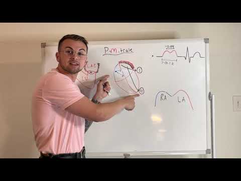 EKG Series: P-Mitrale (Left Atrial Enlargement)