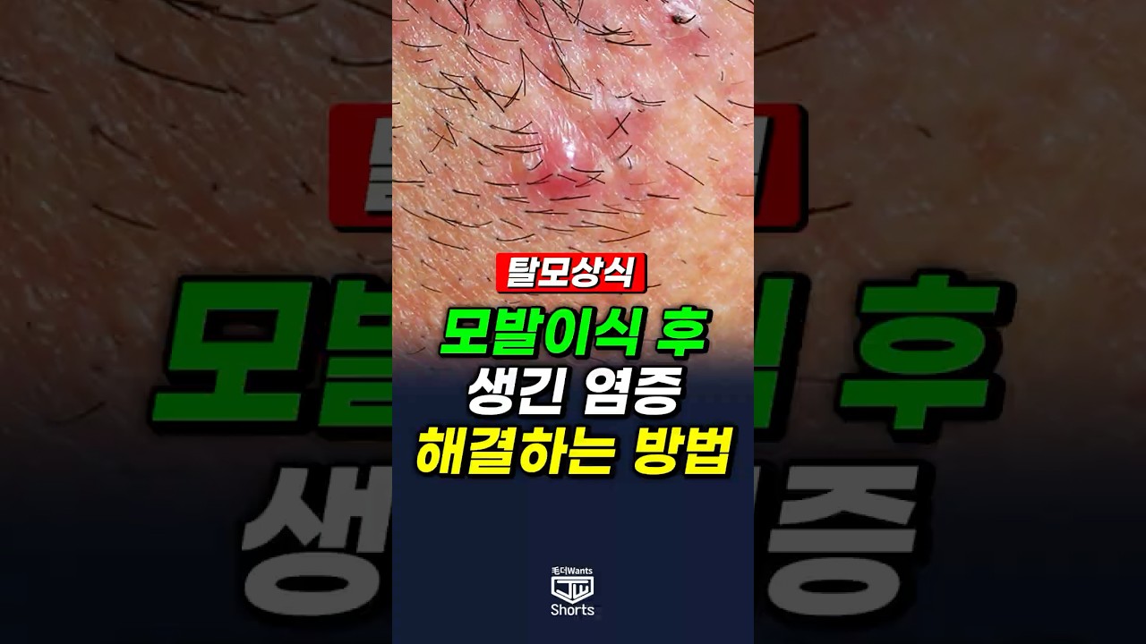 더원츠의원 숏폼