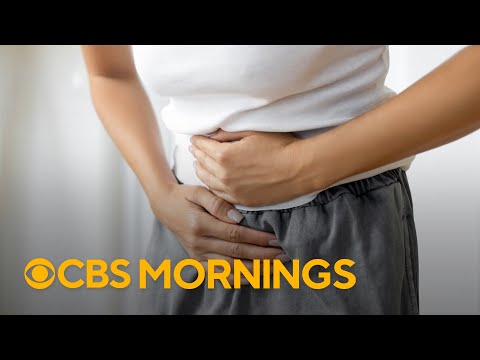 New research shows lifestyle changes may reduce fibroids