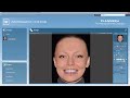 Digital Smile Design DSD Zahnarzt Dr Koch