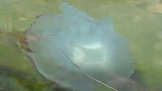 Смотреть онлайн Первая помощь при укусе медузы