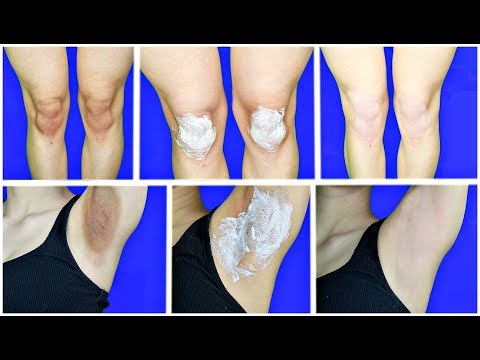 How To Lighten Your Dark Body Parts, Dark Knees, Elbows & Underarms - Simple Beauty Secrets Video