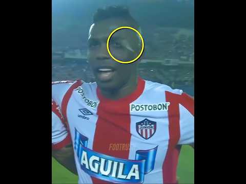 Players vs Insects + GK