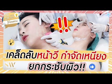 ร้อยไหม หน้าเรียว