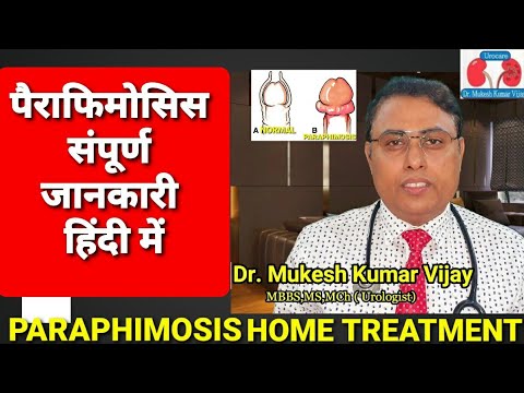Paraphimosis (Paraphimosis) Complete information in Hindi | Paraphimosis Management & Reduction O...
