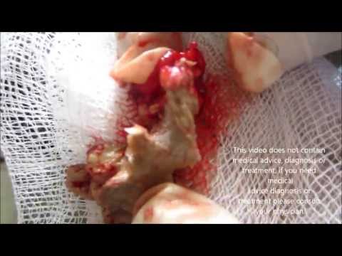 ElPelaOqueNoEsDeBraZZers’s Video 43849225552 122Bb6ImBEg