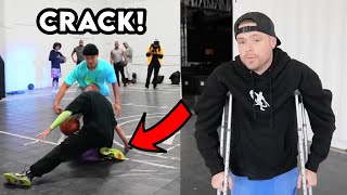 The Professor Breaks His Leg But Will It End His Career? Doctor Explain