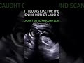 ultrasound scene | mother laughing how baby feels when mother laughs #ultrasound #mothers #pregnancy