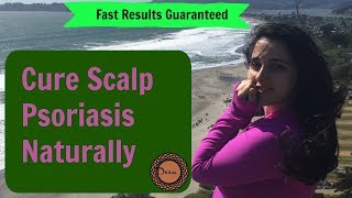★Get Rid of Scalp Psoriasis Permanently  |100% Natural Treatment | Before and After Pictures