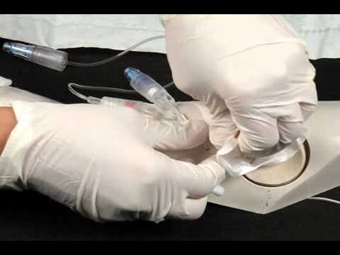 Image of Chapter 8 - PICC Catheter Removal video