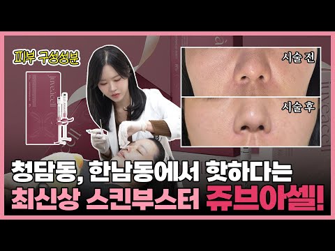 청담동, 한남동에서 핫하다는 최신상 스킨부스터 쥬브아셀! 부천쥬브아셀, 부천hADM부스터, 부천스킨부스터, 부천리투오