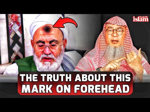 The Truth About Prayer Mark on The Forehead || Sheikh Assim Al Hakeem || #assim