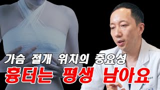 가슴성형시 어디를 절개해야 할지 딱! 말씀드립니다!!! 꼭 끝까지 봐주세요