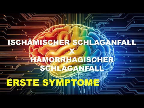 Ischämischer Schlaganfall und hämorrhagischer Schlaganfall. Lernen Sie "FAST" kennen.