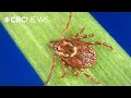 Rocky Mountain spotted fever: what you need to know