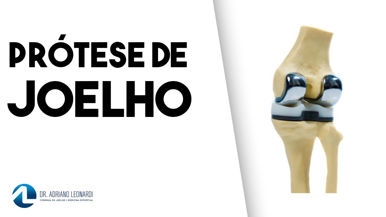 PRÓTESE  DE JOELHO: Como é feita a cirurgia e pós-operatório
