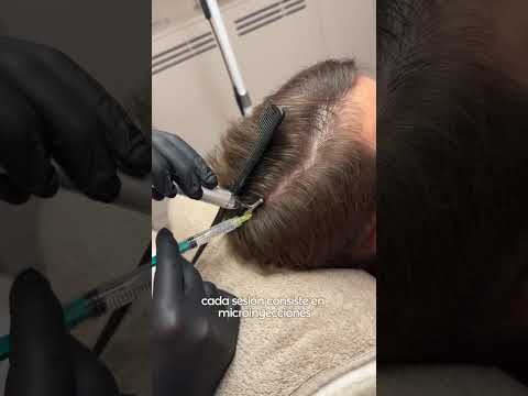 Santé Clínica Estética Barcelona