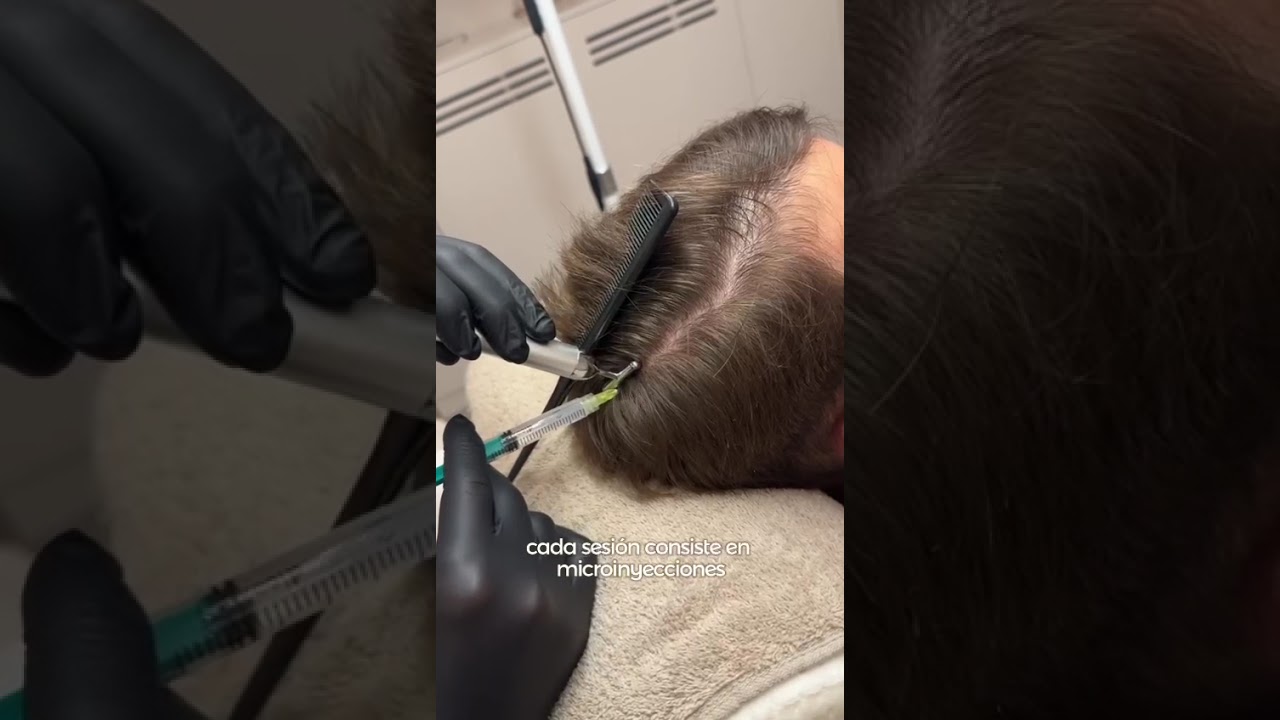 Santé Clínica Estética Barcelona