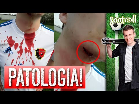 Awantura na meczu B-klasy