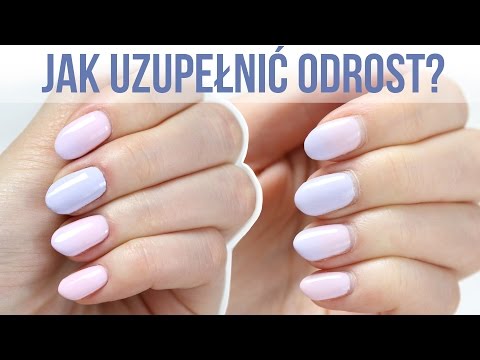 Z kamienia na palcu Equinovarus deformacja stóp ICD 10