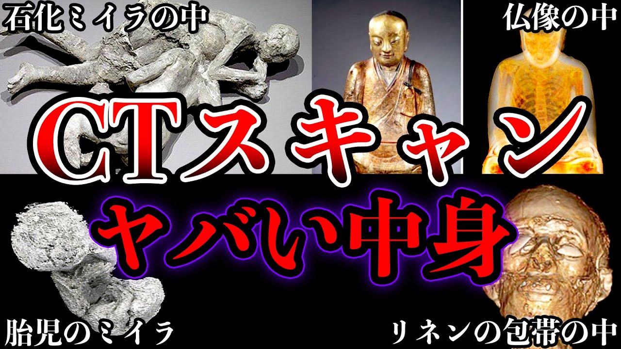 【ゆっくり解説】眠れなくなるほど面白いミイラ集...CT検査やレントゲン検査で中身が明らかになった遺物がヤバイ...