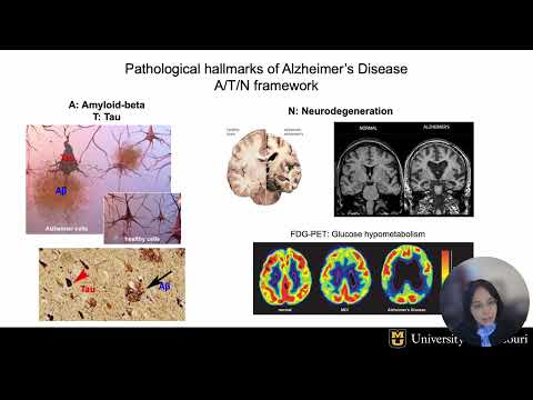 Use Sirolimus (a FDA-approved medication) to mitigate Alzheimer’s disease risk