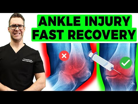 , title : 'BEST Broken Ankle Fracture & Sprained Ankle Recovery TIPS [Top 25]'