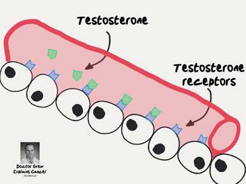 Doctor Explains Hormone Therapy for Prostate Cancer