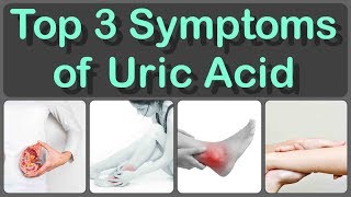 The 3 most common symptoms of high uric acid levels in the body and Gout Symptoms