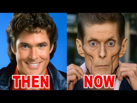 25 Celebrities Who Aged Horribly – You Won’t Believe Their 2025 Transformation!