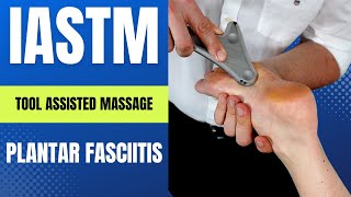 Plantar Fascia IASTM with RockBlade Fascia Tool (Like Graston or Gua Sha) ‘Myofascial Release’
