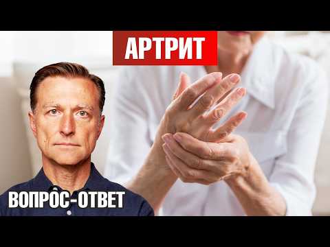 Как остановить развитие артрита?👌 Как остановить развитие артрита?👌