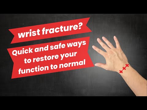 Wrist fracture rehab exercises to restore your function in 12 weeks