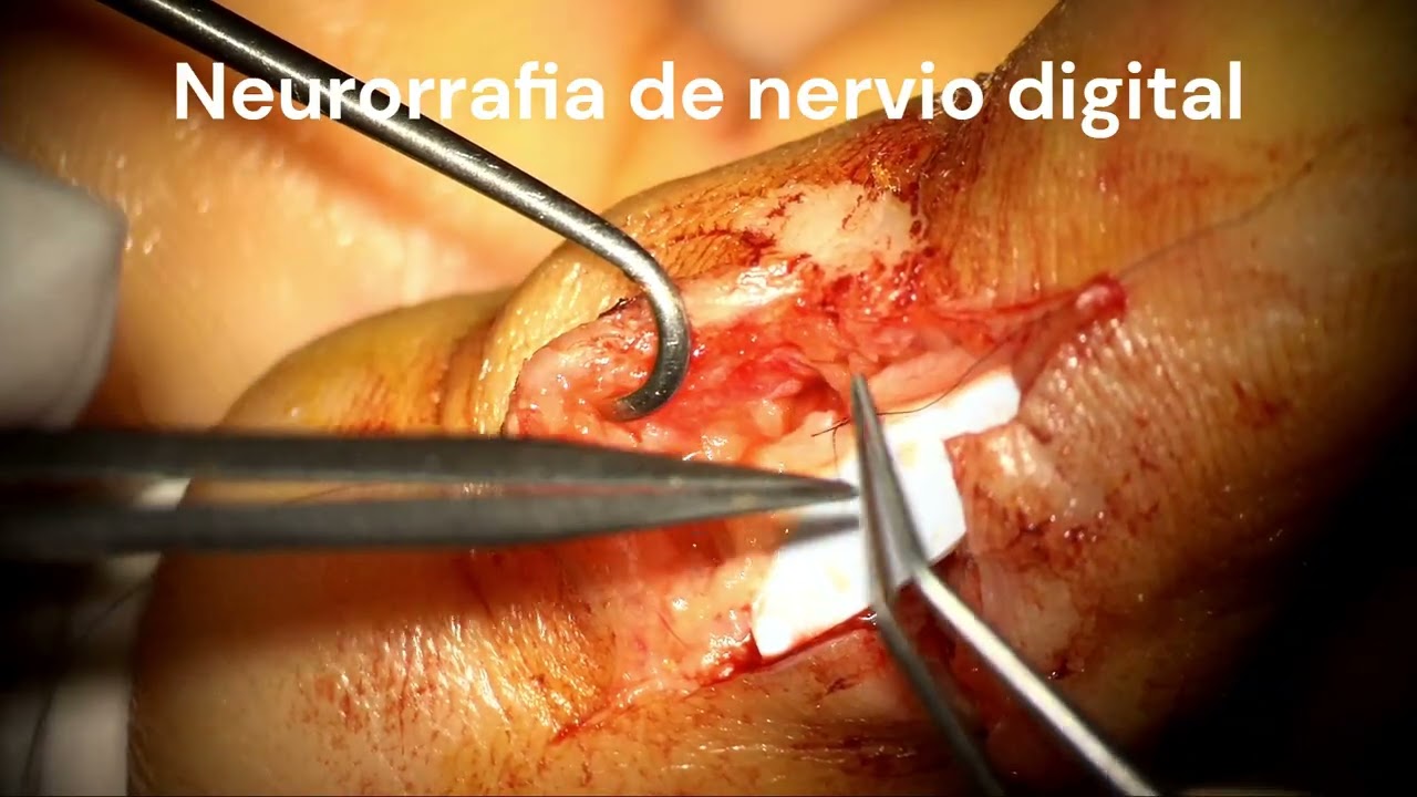 Marcos Fabian Mendoza Guerrero-0