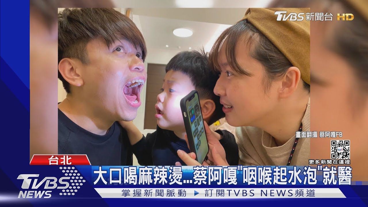蔡阿嘎就醫!大口喝麻辣燙「咽喉起水泡」 藏罹癌風險