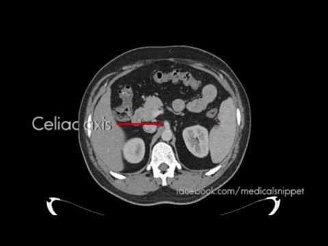 Branches of Celiac Axis