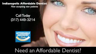preview picture of video 'Indianapolis Affordable Dentist (317) 449-3214'