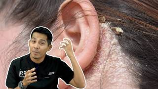 Download lagu Kelemumur Boleh Menyebabkan Botak? mp3 Download lagu Kelemumur Boleh Menyebabkan Botak? mp3